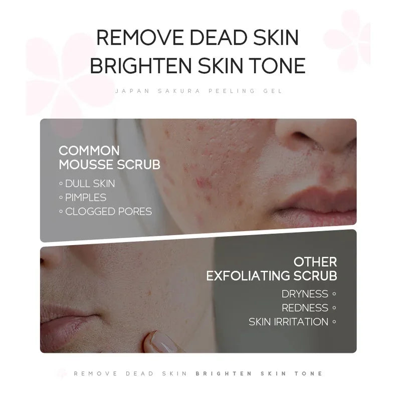 LAIKOU Sakura Peeling Gel Facial Exfoliation Cleans Pores Moisturizing Oil Control 60g