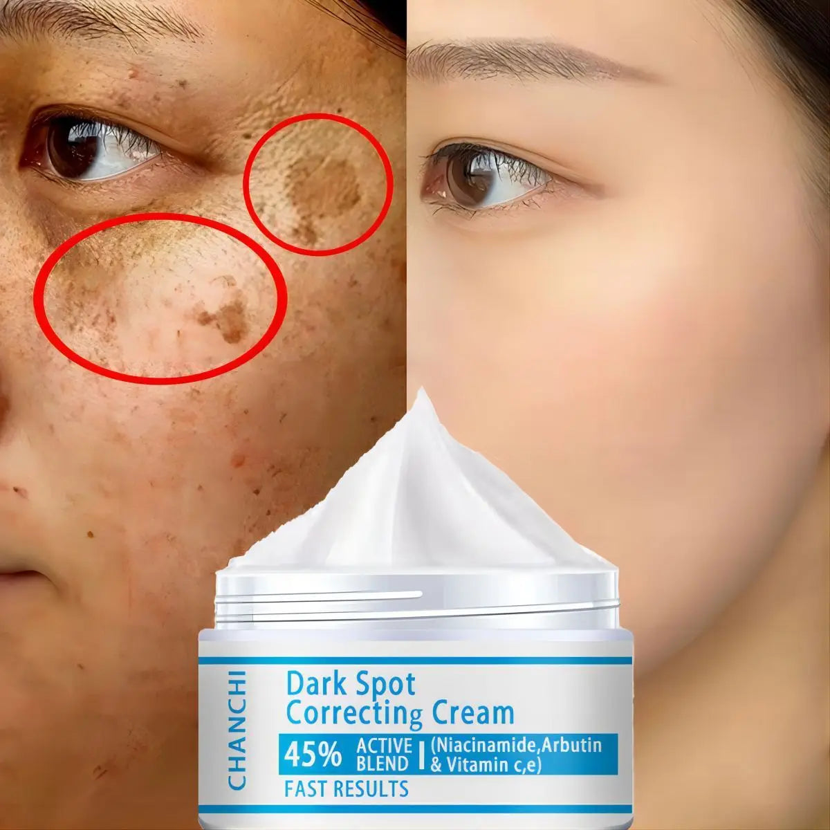Whitening Freckles Cream Remove Melasma Dark Spot Lightening Melanin Brightening Melasma Remover Moisturize Anti-aging Face Care