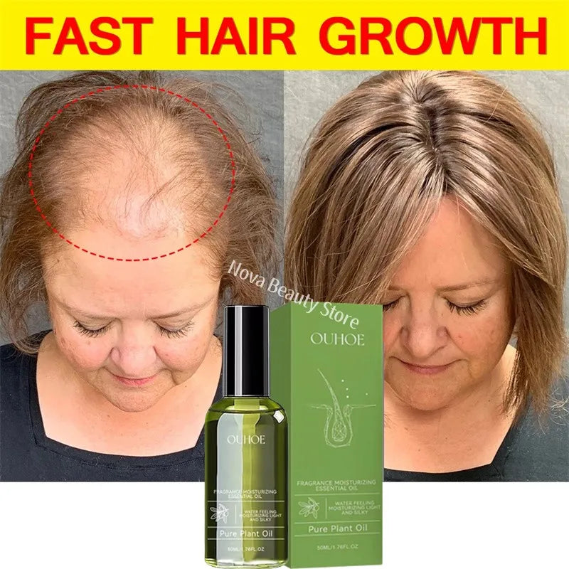 Fast Hair Growth Serum Spray Anti Hair Loss Prevent Baldness Scalp Treatment Repair Roots Beauty Health Hair Care For Men Women