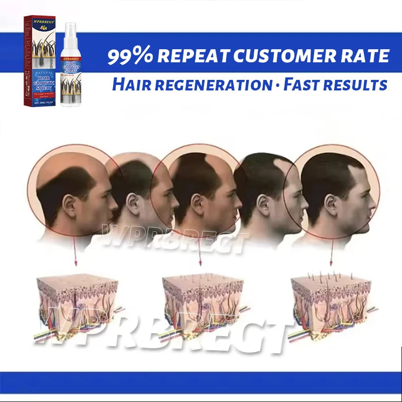 ᴮᵉˢᵗˢᵉˡˡⁱⁿᵍ ᵖʳᵒᵈᵘᶜᵗˢ3rd generation, multi-effect spray, effectively cares for the scalp and prevents breakage