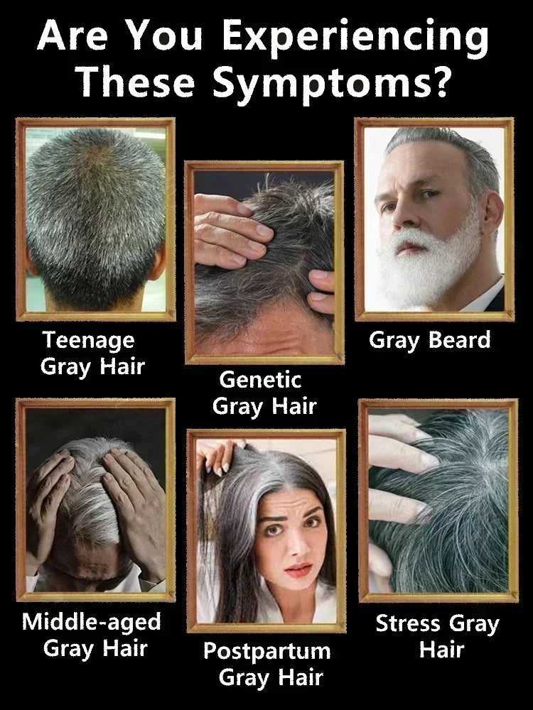 24 NEW White To Black Gray White Hair Serum Natural Color Repair Nourish Essence Anti-gray Care for Men Women