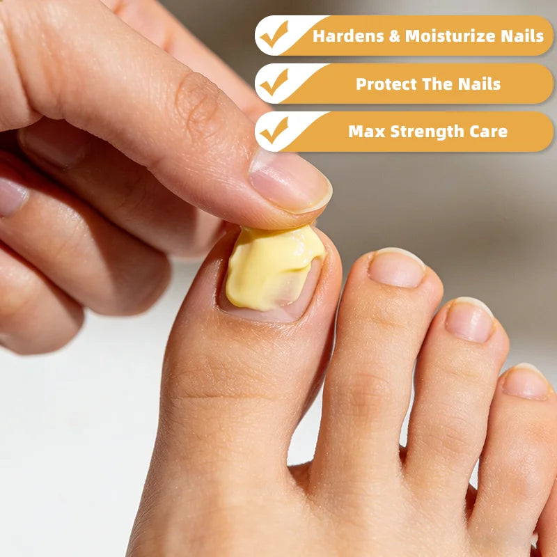 YUITIKUE Bee Venom Nail Care Cream - Max Strength Protection, Smooths & Hardens Nails, Safe & Effective Formula 60g