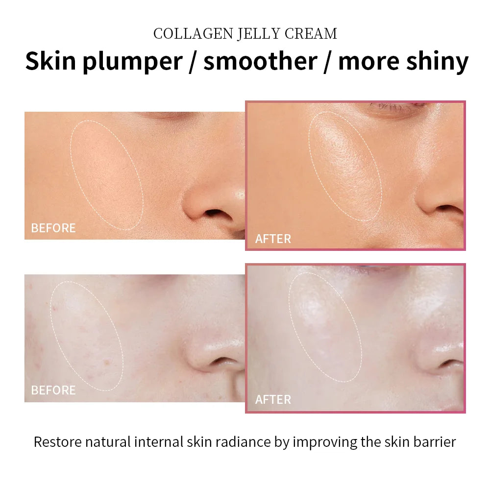 Anti Aging Collagen Face Cream 100ml Niacinamide Moisturizer Hydrating Gel For Tightening Soothing Firmness Skincare