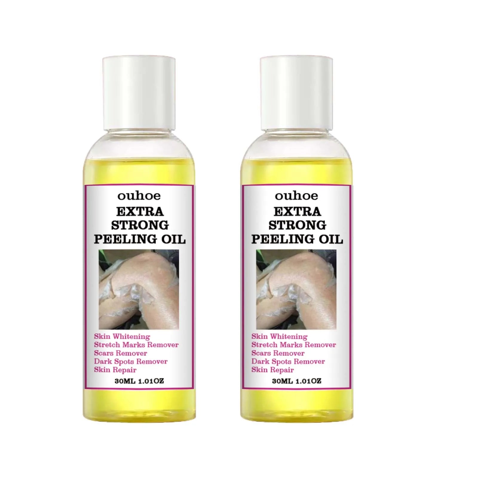 30/110ml Skin Peeling Oil Super Strength Body Peeling Oil Brightening Skin Tone Moisturizing Skin Care Exfoliating Yellow Oil