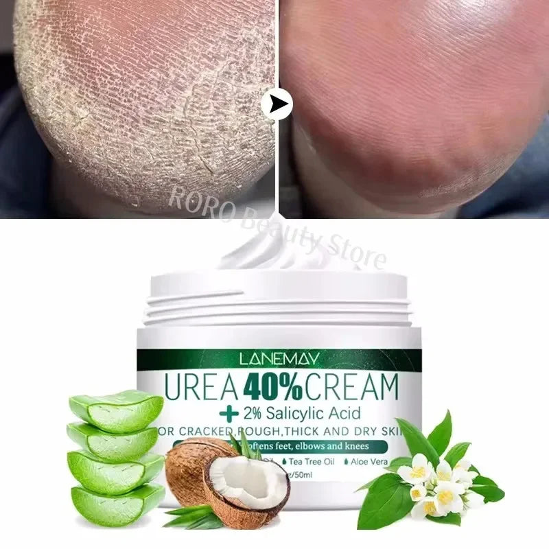 Herbal Anti Crack Foot Cream Heel Cracking Repair Products Exfoliation Dead Skin Removal Softening Moisturize Smooth Skin Care