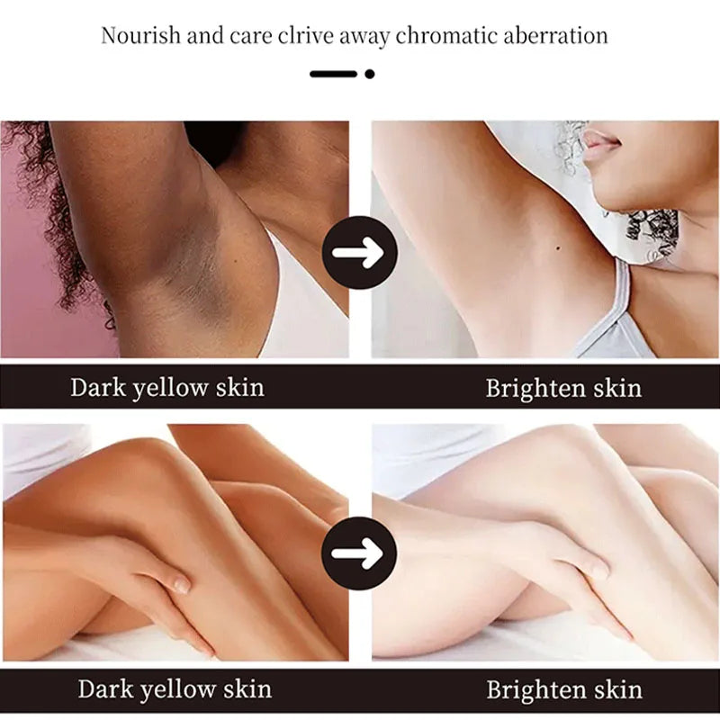 Body Whitening Cream Underarm Knee Buttocks Private Parts Bleach Inner Thighs Intimate Area Remove Melanin Brighten Skin Care