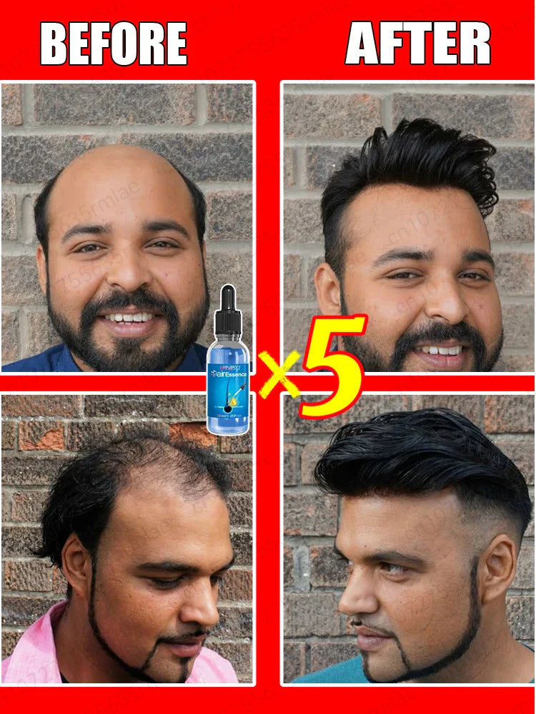 The most effective hair growth essential oil in 2024. Experts authoritatively certified,effective in repairing baldness and hair