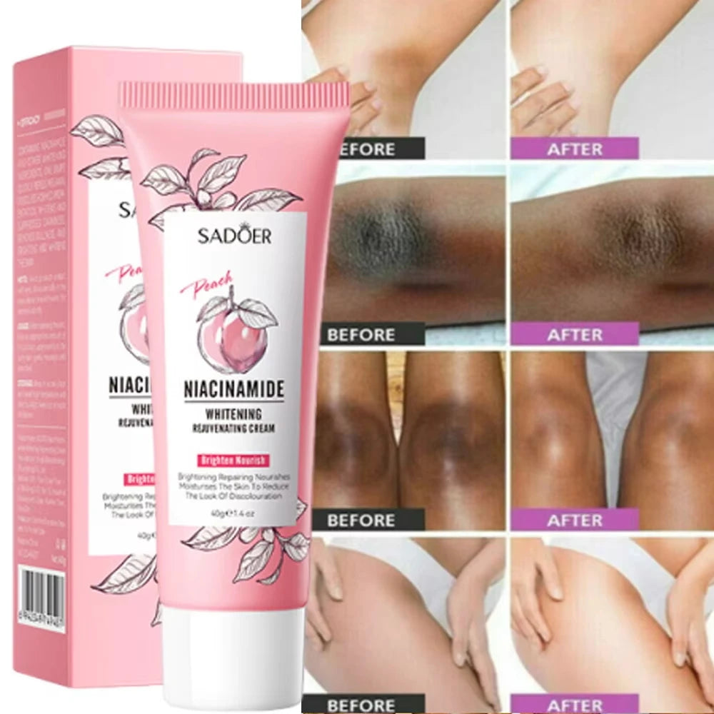 Whitening Cream Private Parts Underarm Butt Knee Whiten Inner Thigh Intimate Parts Dark Remove Melanin Woman Brighten Skin Care
