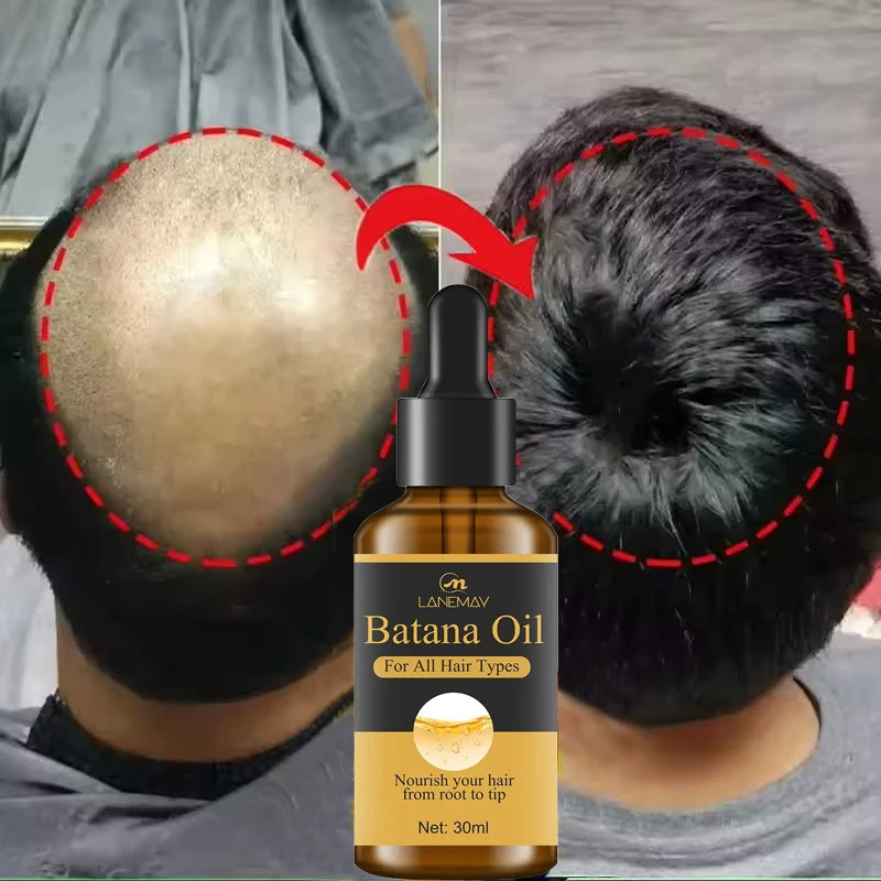 7 Days Fast Batana Oil Hair Growth Serum Anti-loss Hair Regrowth Products Repair Damaged Hair Roots Hair Care For Women Men