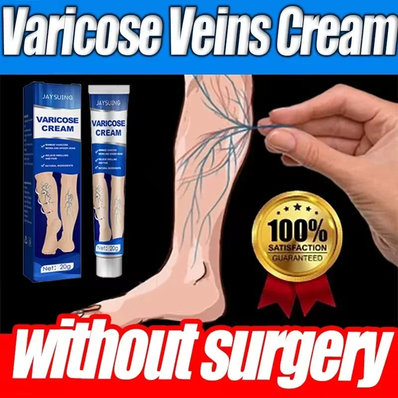 Ointment for Varicose Veins Eliminate Vasculitis Phlebitis to Relieve Spider Leg Pain Treatment Herbal cream