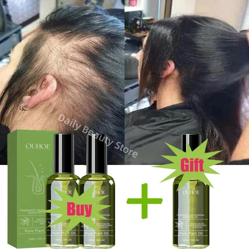 Fast Hair Growth Serum Spray Anti Hair Loss Prevent Baldness Scalp Treatment Repair Roots Beauty Health Hair Care For Men Women