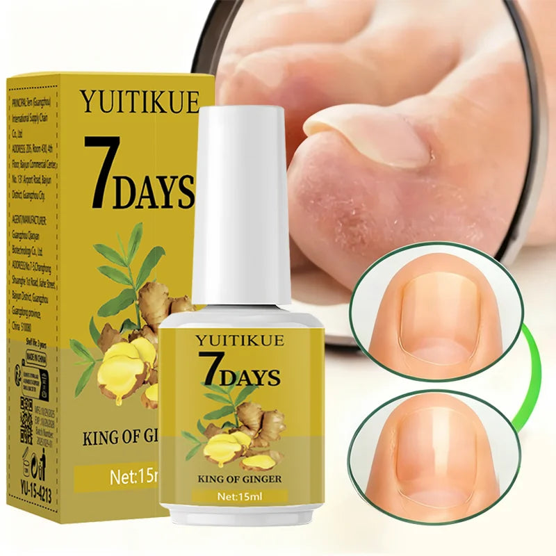 YUITIKUE 7-Day Ginger Nail Care 15ml - Hardens, Smooths & Protects Nails, Max Strength Cuticle Care for Beautiful Nails