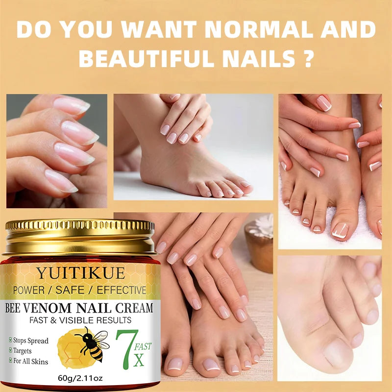 YUITIKUE Bee Venom Nail Care Cream - Max Strength Protection, Smooths & Hardens Nails, Safe & Effective Formula 60g