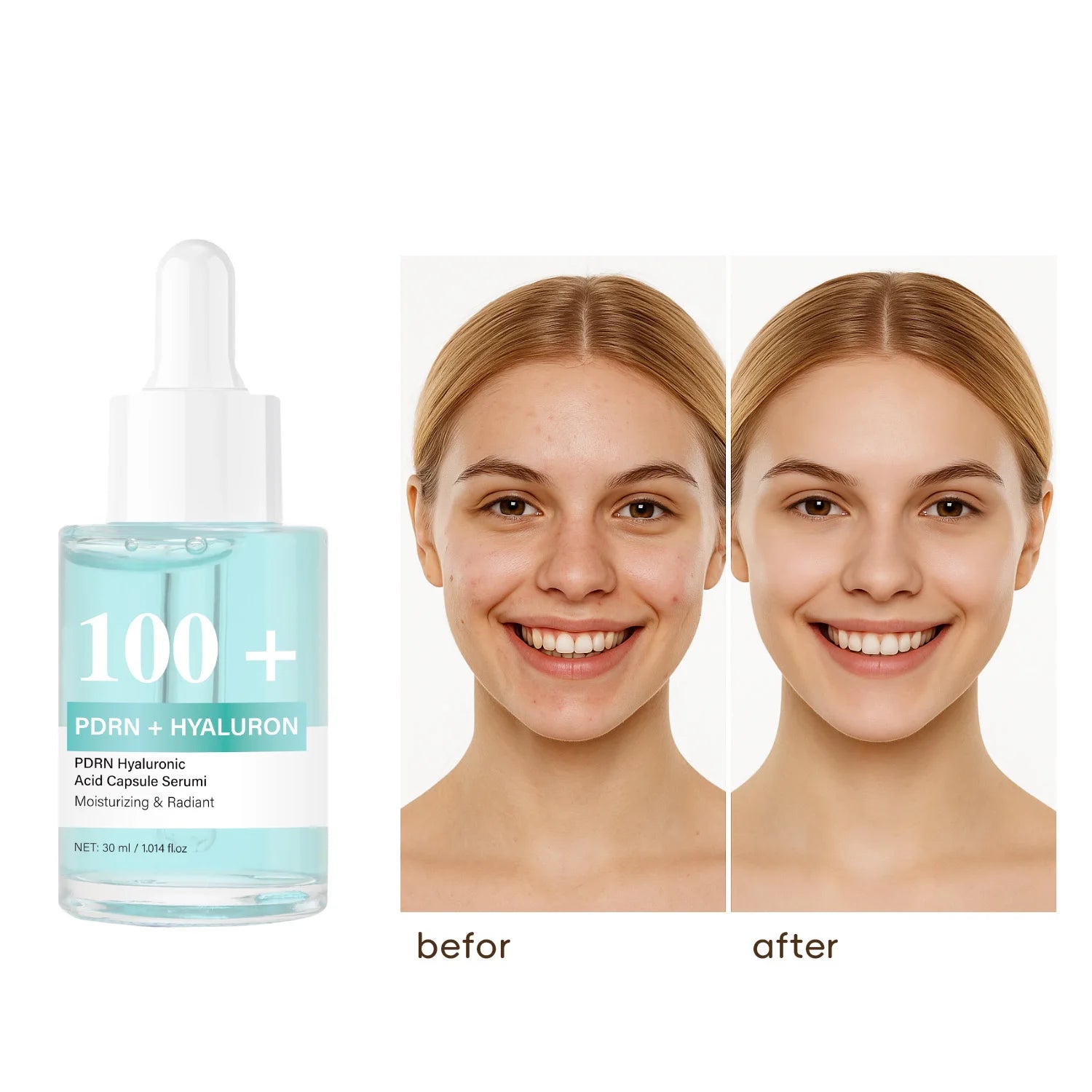 PDRN Hyaluronic Acid Capsule 100 Serum, Radiant Face Serum for Women Hyaluronic Acid, Hydration, Moisture, Korean Skincare, 30ml