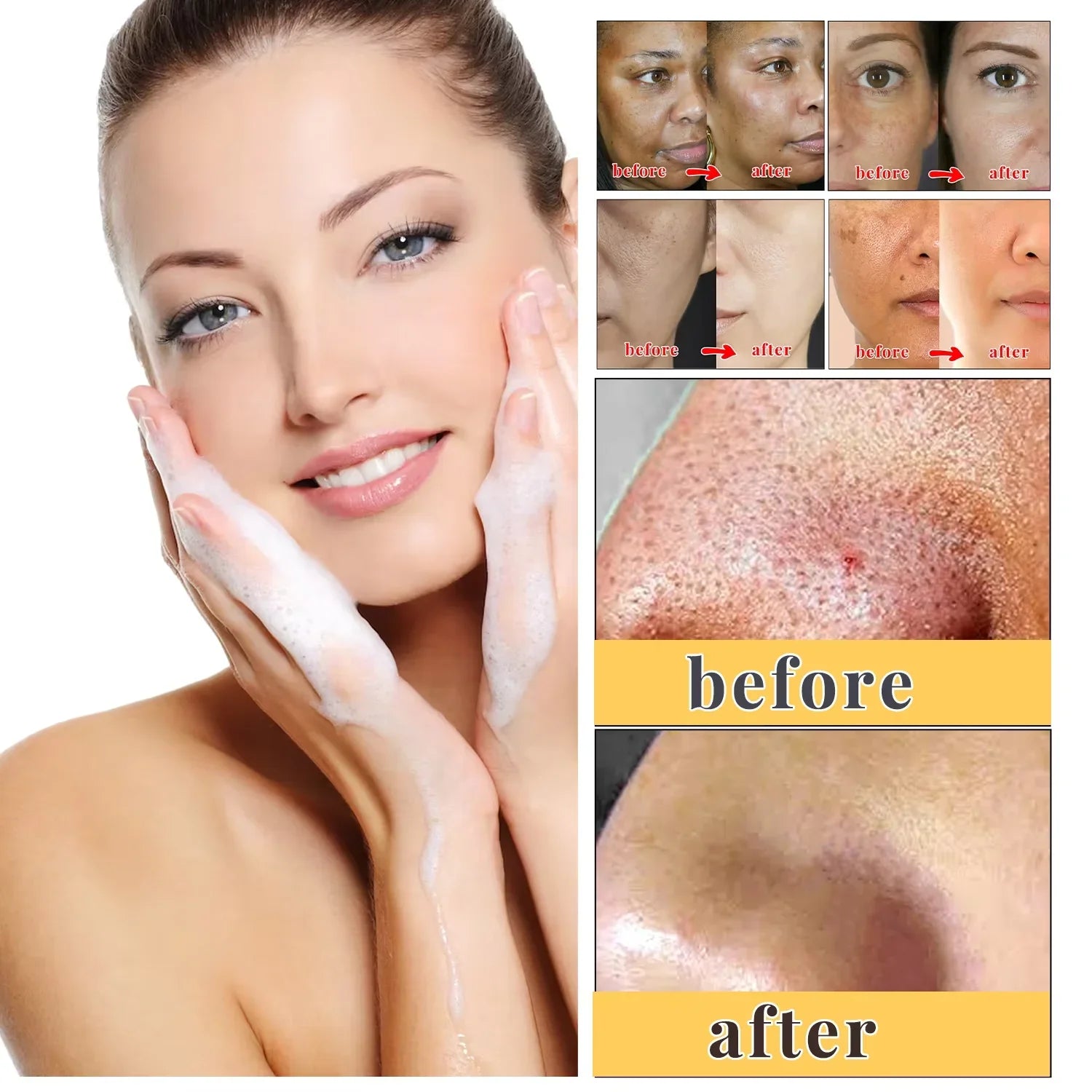 Body Whitening Soap Deep Clean Skin Chicken Skin Removal Soap Armpit Underarm Knees Bleaching Body Brighten White Care Products