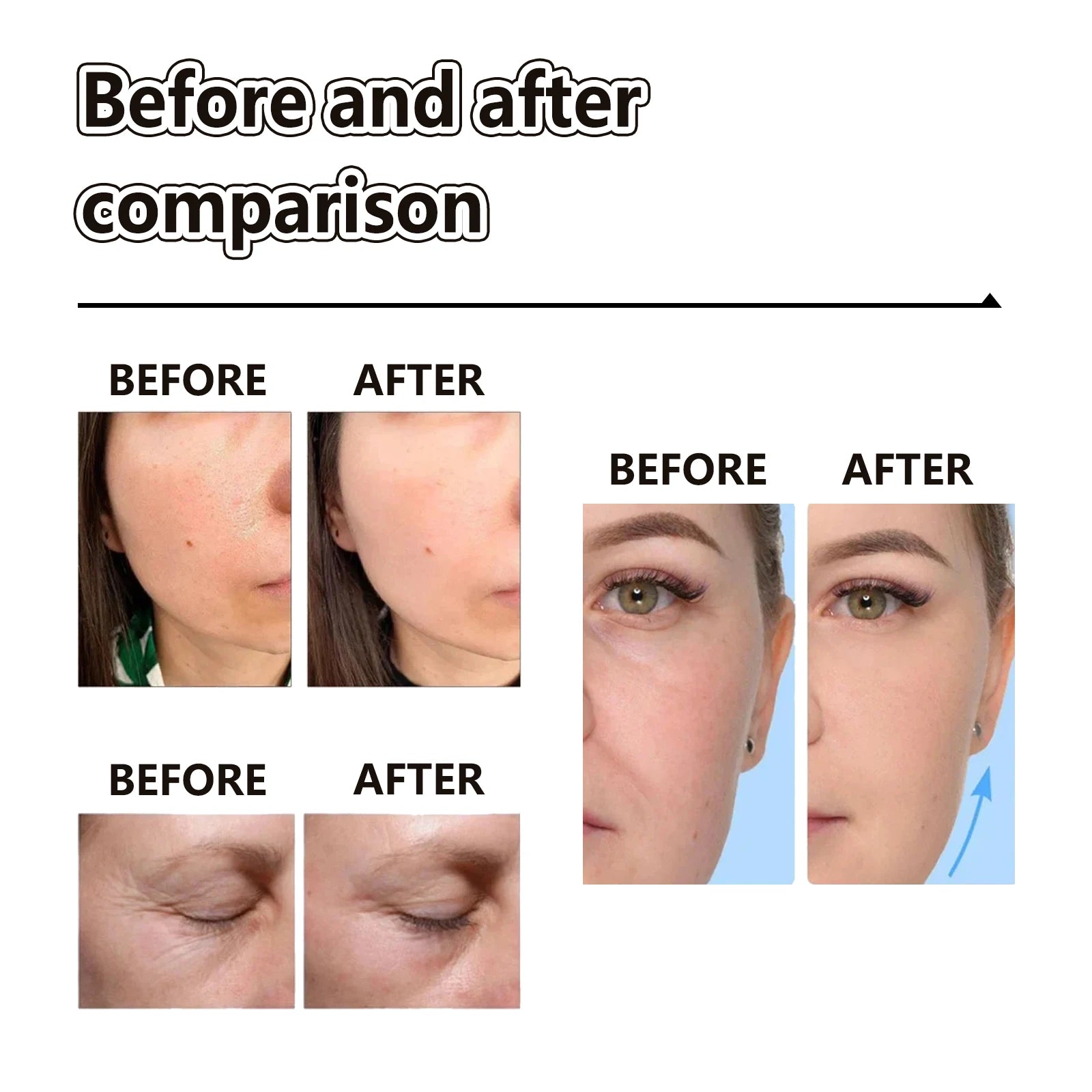 EELHOE Retinol Face Cream Wrinkle Remover Fade Freckle Shrink Pores Moisturizing Day And Night Cream for Face Skin Firming 100ml