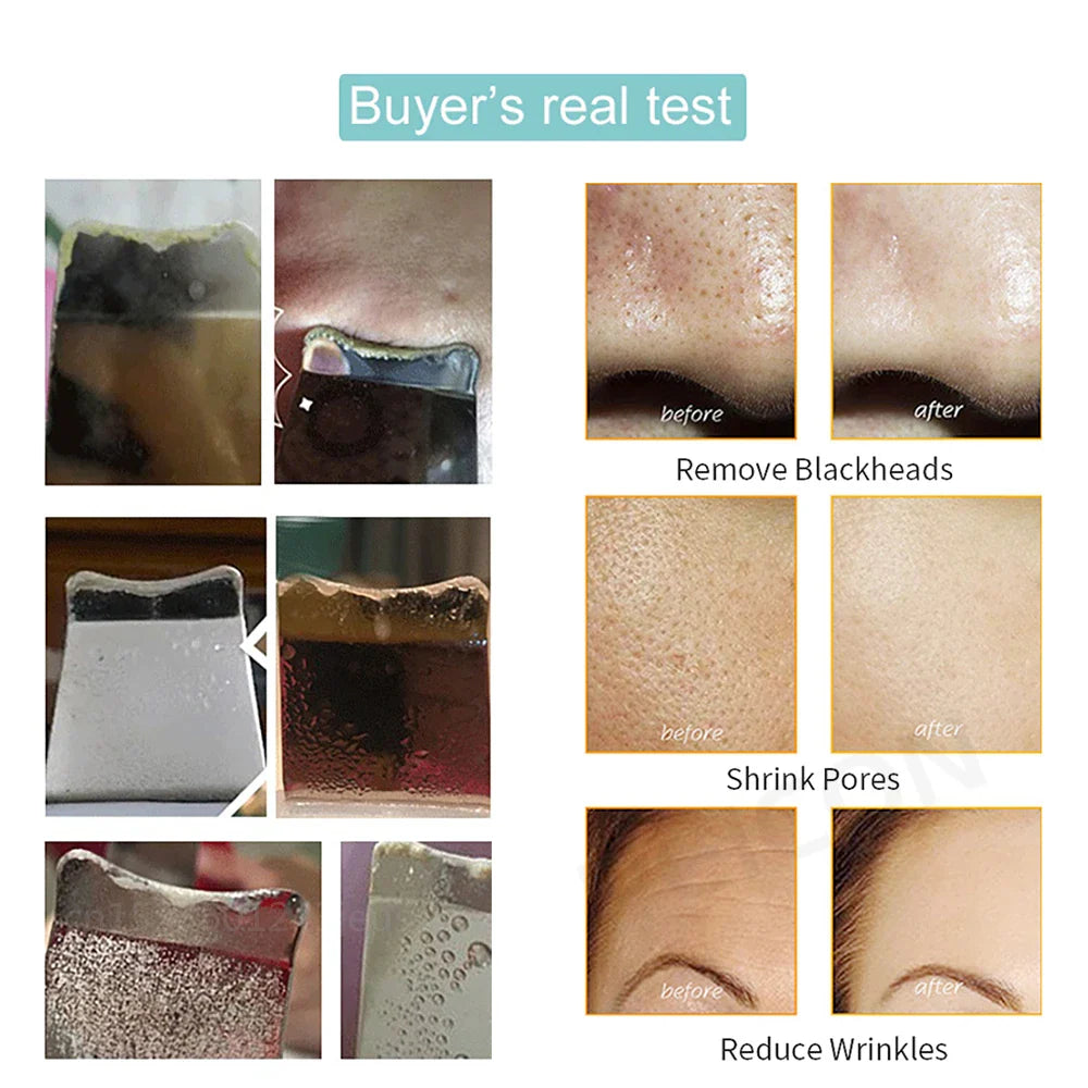 Ultrasonic Skin Scrubber Facial Peeling Face Scrubber Blackhead Remover Ance Pore Deep Facial Cleaning Spatula Facial Cleanser