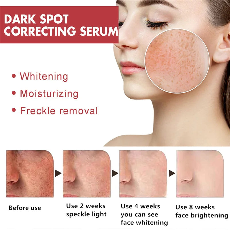 Dark Spots Remover Whitening Serum Face Freckle Melanin Correcting Reduce Fine Lines Brighten Essence Korean Beauty Skin Care