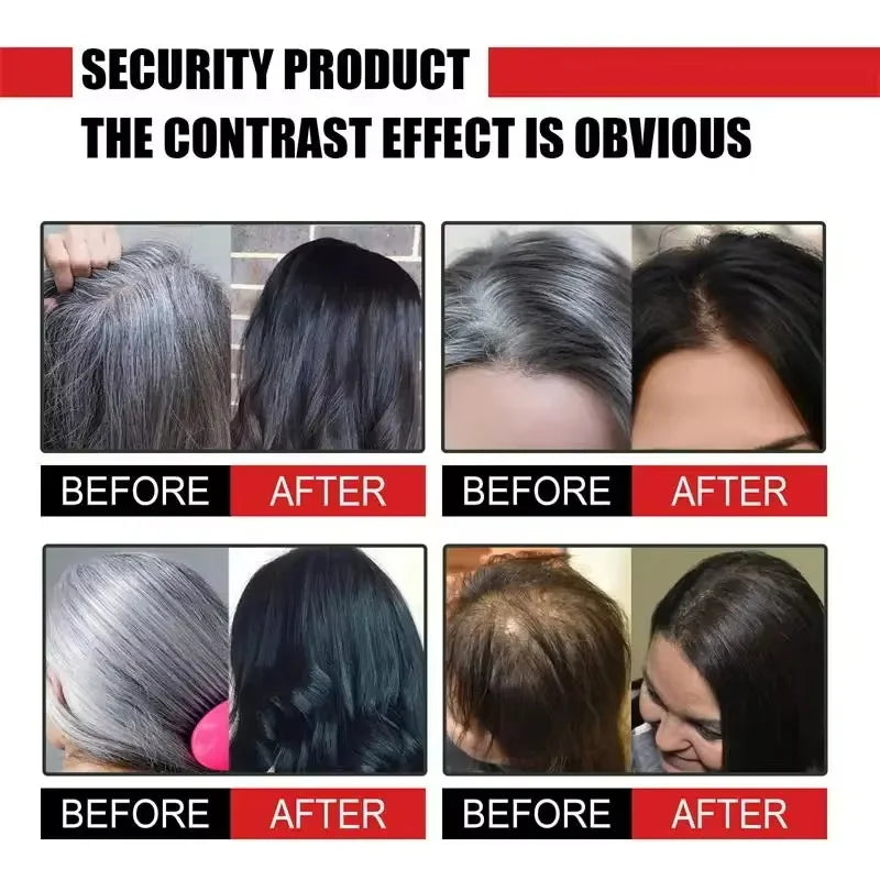 Herbal Anti-grey Hair Treatment Serum Cream White To Black Permanent Repair Natural Color Nourish Scalp Hair Care Products
