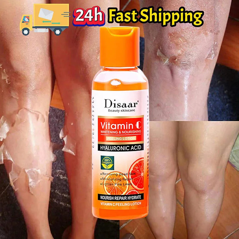 Yellow Peeling Lotion Oil 100% Organic Bleaching Dark Skin Exfoliating Whitening Nourishing Hyaluronic Acid Moisturiz Body Scrub