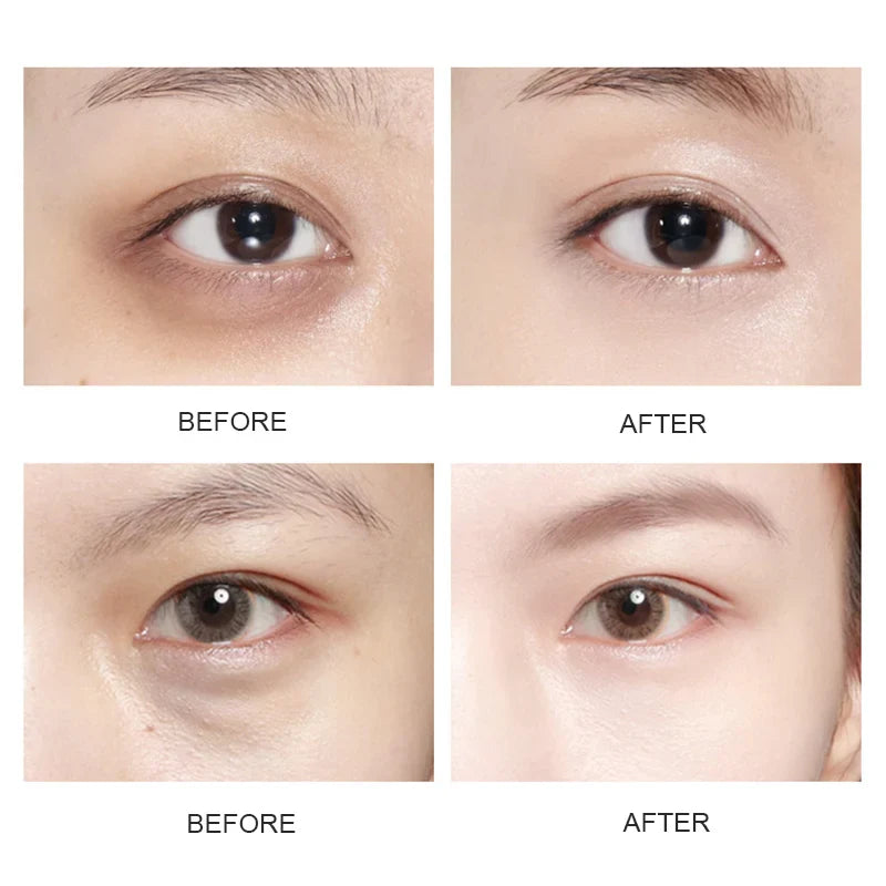 5/10/20/30 Pairs Crystal Gold Eye Patches Anti Dark Circles Remove Eye Bags Moisturizing Golden Collagen Eye Mask Skin Care Eyes