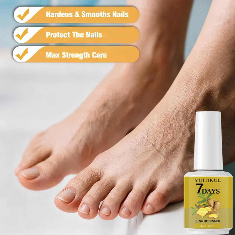 YUITIKUE 7-Day Ginger Nail Care 15ml - Hardens, Smooths & Protects Nails, Max Strength Cuticle Care for Beautiful Nails