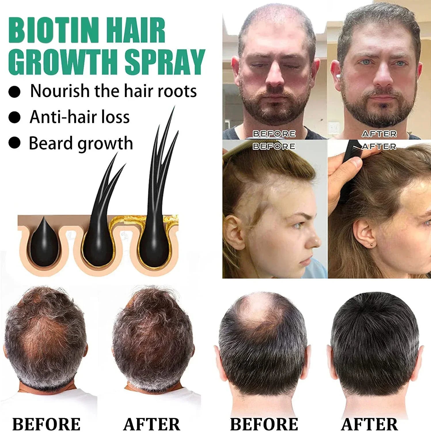 Biotin Hair Growth Serum Anti Hair Loss Spray Scalp Treatment Fast Growing Essential Oils For Men Women Hair Care Products 2024