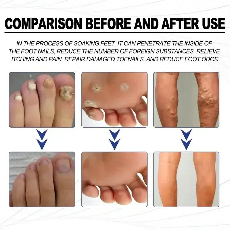 Foot Soaking Salts Pedicure Foot Softening Soak Pedicure Foot Soak Foots 10pcs Organic Foot Softening Capsule Shape Up Care