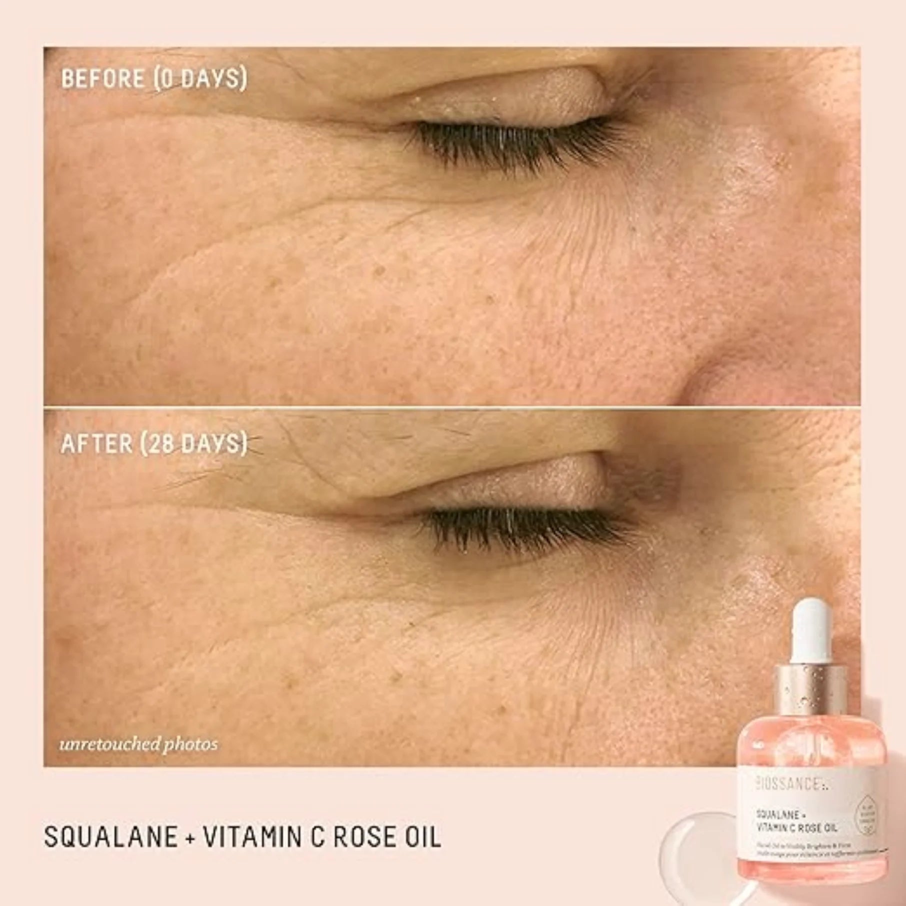 BIOSSANCE Squalane + Vitamin C Rose Advanced Facial Oil - Brightening, Firming, and Hydrating Serum for All Skin Types