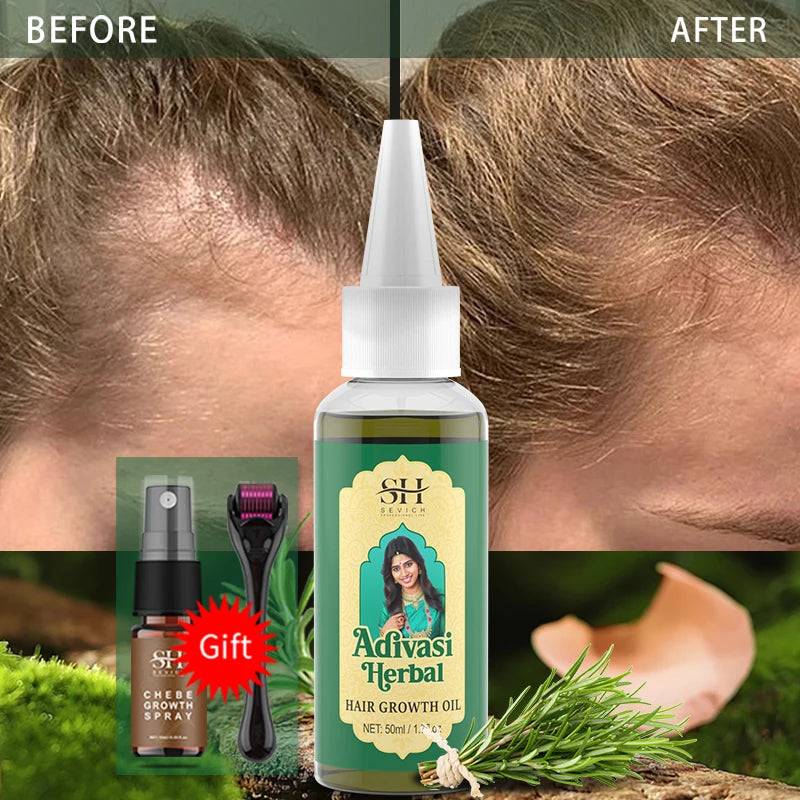 Ayurvedic Hair Growth Oil India Adivasi herbal Hair Growth Oils Anti Hair Loss Fast Regrowth Thicken Serum Hair Growth Products